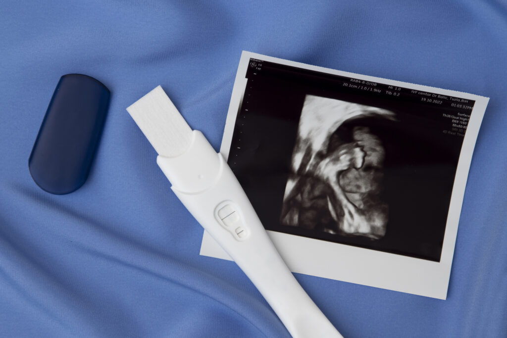 Pregnancy test and ultrasound image representing pregnancy testing services
